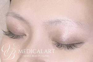 眉アートメイク症例一覧 施術前