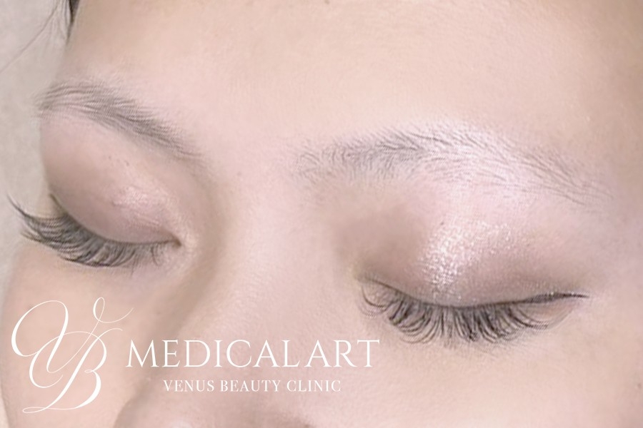 眉アートメイク症例一覧 施術前