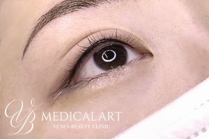 アイラインアートメイク 施術後