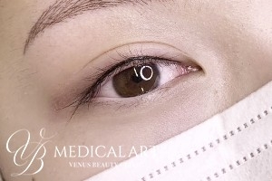 アイラインアートメイク 施術後