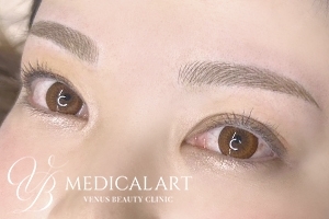 眉アートメイク症例一覧 施術後