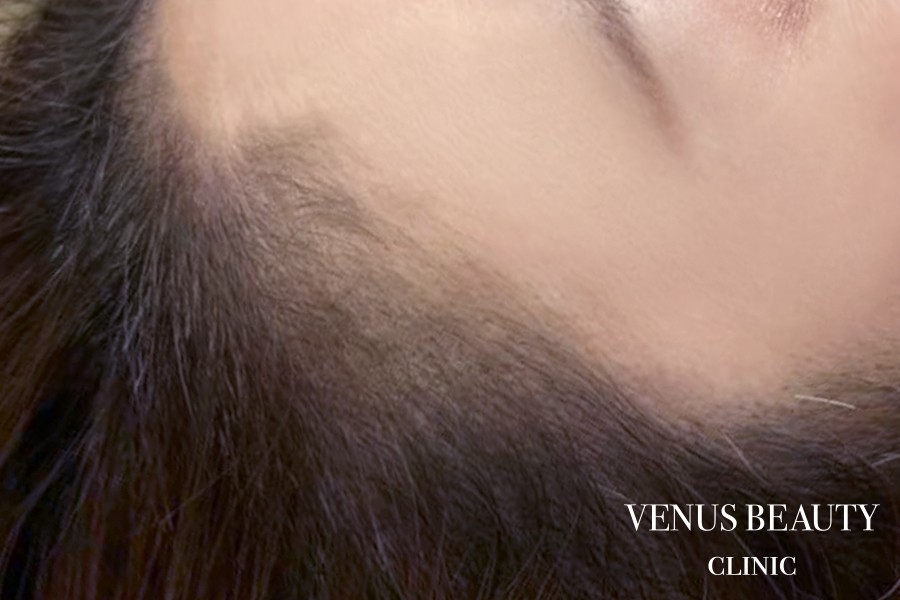 ヘアアートメイク症例一覧 施術後