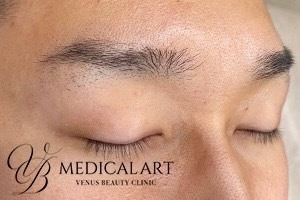 男性20代眉アートビフォア