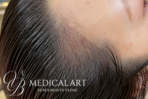 ヘアアートメイクAfter01