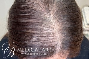 ヘアアートメイクAfter02