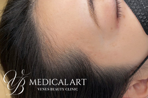 ヘアアートメイクBefore01