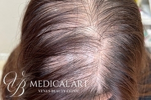 ヘアアートメイクBefore02