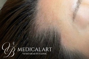 ヘアアートメイクBefore03