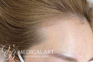 ヘアアートメイクBefore02