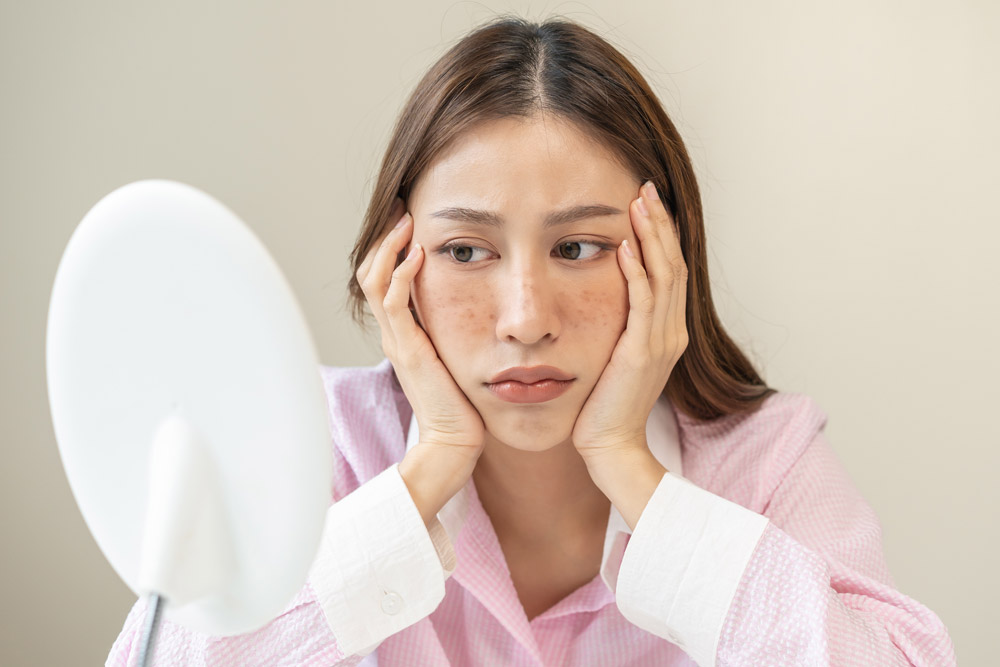 シミとそばかすの違いは何？それぞれの予防・対策方法を解説！